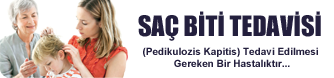 Saç Biti Tedavisi - Saç Biti