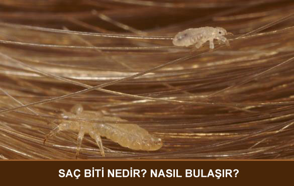 sac-biti-nedir-nasil-bulasir